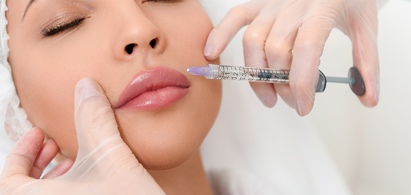 Collagen Fillers